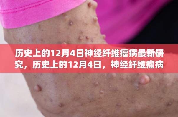 歷史上的神經(jīng)纖維瘤病研究之旅,與自然美景共舞,探尋內(nèi)心寧靜港灣的新突破