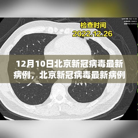 北京新冠病毒最新病例分析報告,深度解讀(截至12月10日)