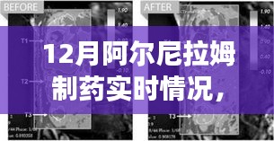 阿爾尼拉姆制藥12月實時動態,生產進展、市場洞察一覽無余