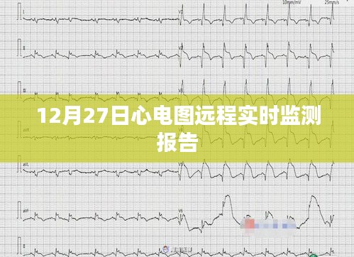 心電圖遠程實時監測報告,實時數據監測,健康無憂
