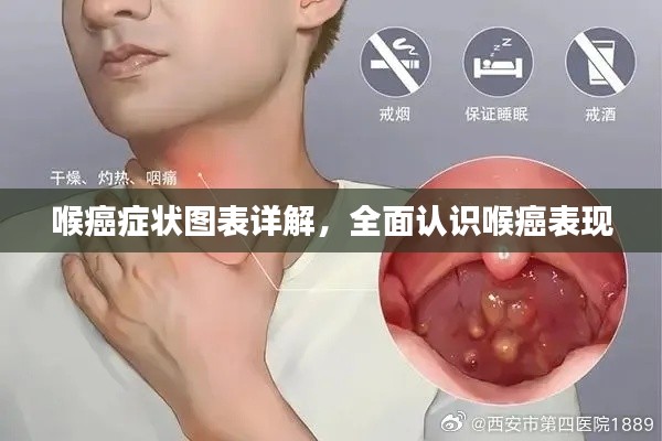 喉癌癥狀圖表詳解，全面認識喉癌表現