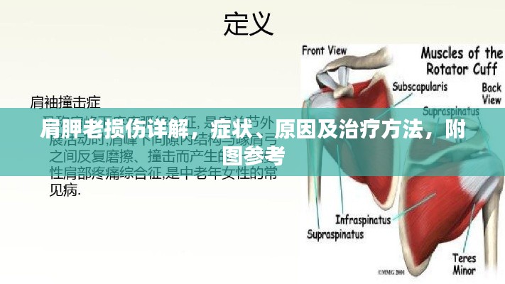 肩胛老損傷詳解,癥狀、原因及治療方法,附圖參考