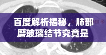百度解析揭秘,肺部磨玻璃結節究竟是何物?