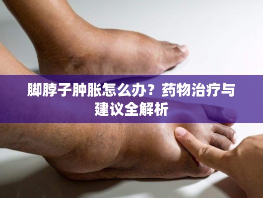 腳脖子腫脹怎么辦?藥物治療與建議全解析